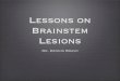 Brainstem Lesions