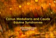 Conus Medullaris and Cauda Equina Syndromes