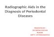 Radiographic Aids in the Diagnosis of Periodontal Diseases