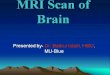 Mri scan of brain