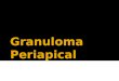 Granuloma Periapical