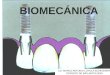 Biomecánica en Implantología