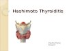 hashimoto thyroiditis