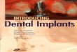 Introduction Dental Implant