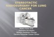 Stereotactic Radiosurgery for Lung Cancer