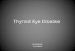 Thyroide Eye Disease