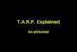 TARP Explained