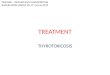 TREATMENT THYROTOXICOSIS