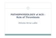 Patophysiology of ACS: Role of Thrombosis