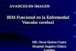 IRM Funcional en la Enfermedad Vascular cerebral DR. Oscar Quiroz Castro Hospital Angeles Clínica Londres AVANCES EN IMAGEN