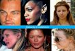 Celebrity skin: Stars with acne