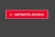2 - ARTRITIS AGUDA. Artritis Aguda Afecta en la infancia antes de los 3 años (recién nacido ++) Compromete sobre todo la rodilla y la cadera