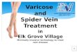 Varicose Vein Treatment and Spider Vein Removal In Chicago