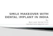 Smile makeover with dental implant in india