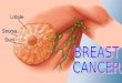 Breast Cancer.ppt