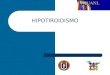 HIPOTIROIDISMO. HIPOTIROIDISMO Clasificación Primario – Tiroides Secundario – Hipófisis Terciario – Hipotálamo