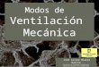 Modos de Ventilación Mecánica José Javier Blanco García Servicio de Cuidados Intensivos Hospital General de Cuidad Real