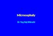 9-Microcephaly- MR