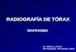 RADIOGRAFÍA DE TÓRAX. PATRONES RADIOLÓGICOS. DIAFRAGMA