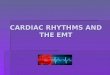 CARDIAC RHYTHMS AND THE EMT. What We Need to Know: V-Fib V-Fib V-Tach V-Tach Asystole Asystole