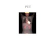 PET. PET- POSITRON EMISSION TOMOGRAPHY NONINVASIVE NUCLEAR IMAGING TECHNIQUE THAT INVOLVES THE ADMINISTRATION OF A RADIOPHARMACEUTICAL AND SUBSEQUENT