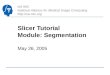 NA-MIC National Alliance for Medical Image Computing  Slicer Tutorial Module: Segmentation May 26, 2005