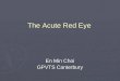 The Acute Red Eye En Min Choi GPVTS Canterbury. The Acute Red Eye Most common ocular complaint Most common ocular complaint Common- children and adults