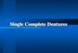 Single Complete Dentures. Maxillary Single Dentures More common More common Teeth usually lost before their mandibular antagonists Teeth usually lost