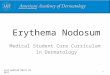 Erythema Nodosum Medical Student Core Curriculum in Dermatology Last updated March 23, 2011 1