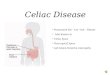 Celiac Disease Pronounced See - Lee -Ack - Disease Also Known as Celiac Spure Non tropical Spure and Gluten-Sensitive enteropathy