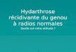 Hydarthrose récidivante du genou à radios normales Quelle est votre attitude ? 1