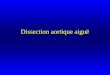 Dissection aortique aiguë. I)Généralités II)Causes III)Anatomo-pathologie IV)Diagnostic Positif V)Diagnostic différentiel VI)Histoire naturelle et évolution