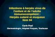 Infections à herpès virus de lenfant et de ladulte immunocompétent : Herpès cutané et muqueux Item 84 Carle Paul Dermatologie, Hôpital Purpan, Toulouse