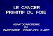LE CANCER PRIMITIF DU FOIE HEPATOCARCINOME OU CARICINOME HEPATO-CELLULAIRE LE CANCER PRIMITIF DU FOIE HEPATOCARCINOME OU CARICINOME HEPATO-CELLULAIRE