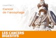 Cancer de l’œsophage CHAPITRE I. La Lettre du Cancérologue Inclusion –Cancer de l’œsophage ou du cardia (Siewert I ou II) –ADK ou épidermoïde (EOA) –1