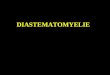 DIASTEMATOMYELIE. n Malformation rare de la moelle épinière n Dysraphisme occulte n Split Cord Malformation (SCM): division longitudinale de la moelle