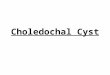 Choledochal Cyst Compiled)