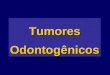 TumoresOdontogênicos. Tumores Odontogênicos - Odontogênese