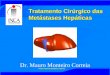 Tratamento Cirúrgico das Metástases Hepáticas Dr. Mauro Monteiro Correia 