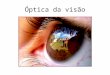 Óptica da visão. Miopia P.F. antes da retina; Alongamento do globo ocular, excesso na curvatura do cristalino e/ou cornea. Lente corretiva divergente