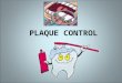 Mechanical Plaque Control
