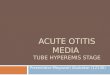 Acute Otitis Media Ppt