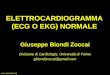 Www.metcardio.org ELETTROCARDIOGRAMMA (ECG O EKG) NORMALE Giuseppe Biondi Zoccai Divisione di Cardiologia, Università di Torino gbiondizoccai@gmail.com
