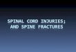 Spinal cord injuries spinalfractures thoracolumbar fracture