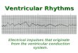 Ventricular Rhythms - BMH/Tele