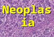 Pathology  neoplasm