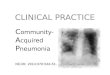 Community- Acquired Pneumonia