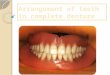 Arrangement of teeth in complete denture