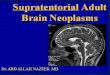 Presentation1.pptx, supratentorial brain tumour