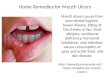 Natural Home Remedies for Mouth Ulcers- iHomeRemedy